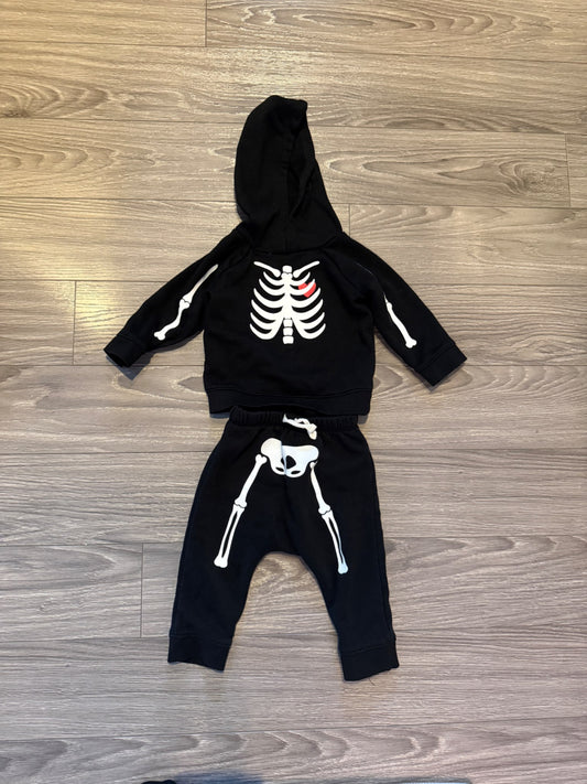 Black Skeleton Sweatsuit (6-12 Months), Kids 12 Month (9-12M)