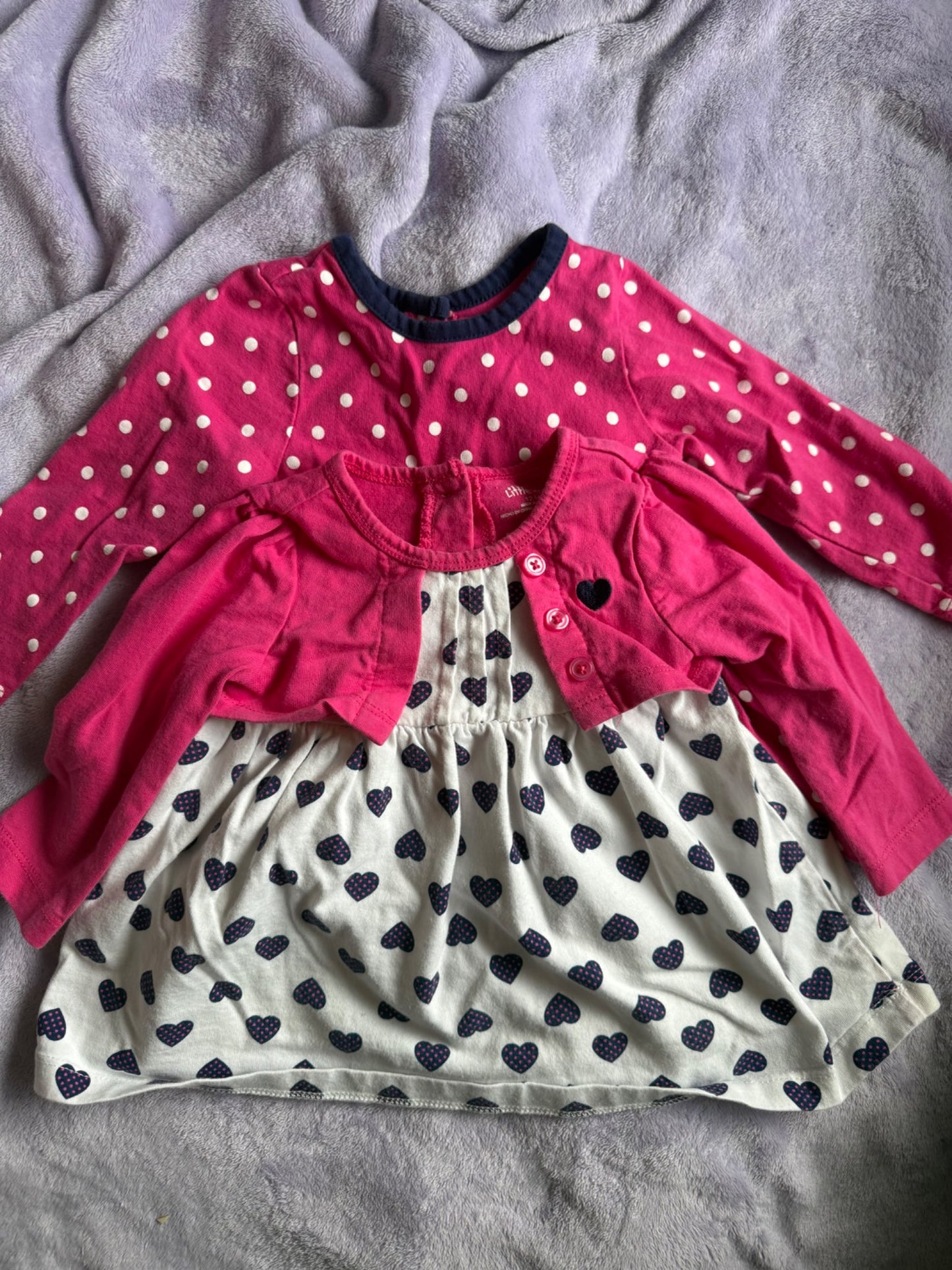 2 dressy shirts/dresses bundle, Kids 12 Month (9-12M)
