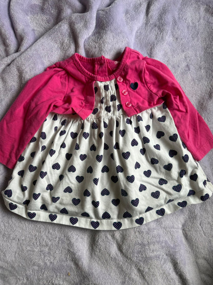 2 dressy shirts/dresses bundle, Kids 12 Month (9-12M)