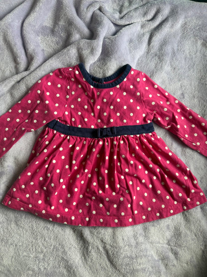 2 dressy shirts/dresses bundle, Kids 12 Month (9-12M)